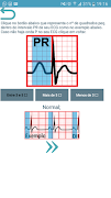 ECG Report Screenshot 4