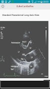EchoCardioPro ภาพหน้าจอ 4