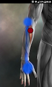 Trigger Points screenshot 7