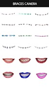 Braces Camera تصوير الشاشة 1