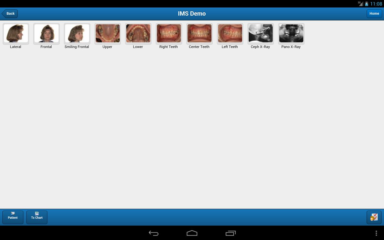 download Photo Excited Charge Collection