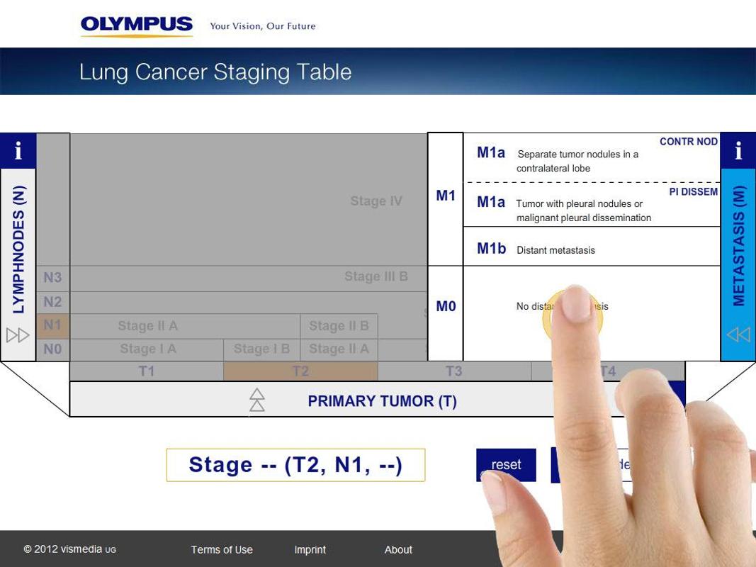Lung Cancer Staging Table APK Download - Free Medical APP for Android