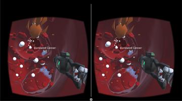 XCancer - VR Game capture d'écran 2