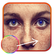 Freckles Photo Edit – Beauty Salon