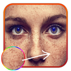 Freckles Photo Edit – Beauty Salon icon