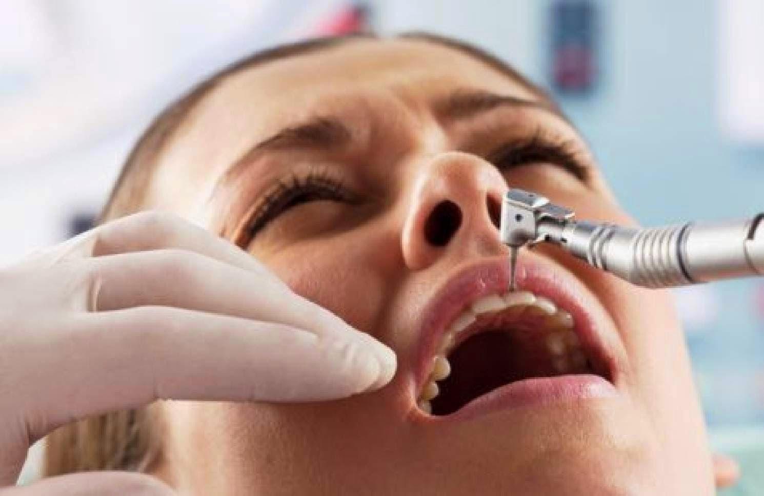 Лечение заболевшего зуба. Укол в Десну у стоматолога. Бормашина зубная. Стоматолог сверлит зуб.