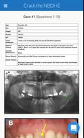 NBDHE - Dental Hygiene Prep Ekran Görüntüsü 1