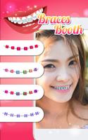 Braces Booth Plus ảnh chụp màn hình 2