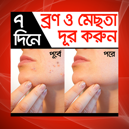 ৭ দিনে ব্রণ ও মেছতা দূর করুন - Bron mesta dur