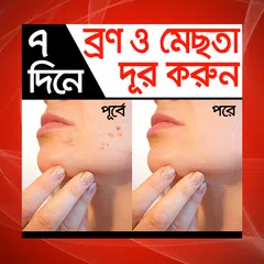 ৭ দিনে ব্রণ ও মেছতা দূর করুন - Bron mesta dur アプリダウンロード