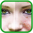 acne skin makeup APK