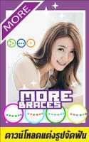 Selfie Braces Teeth Booth App Affiche