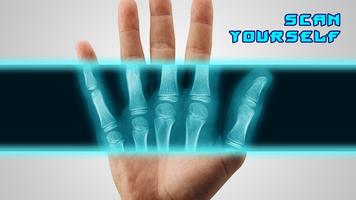 Best X-Ray FREE پوسٹر