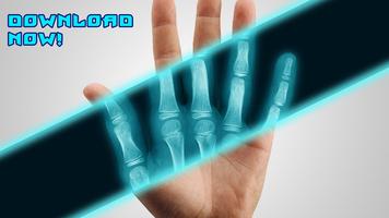 Best X-Ray FREE screenshot 2