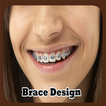 Brace Design