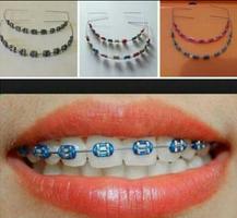 Braces Teeth imagem de tela 3