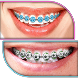 Braces Teeth Booth Camera App icon