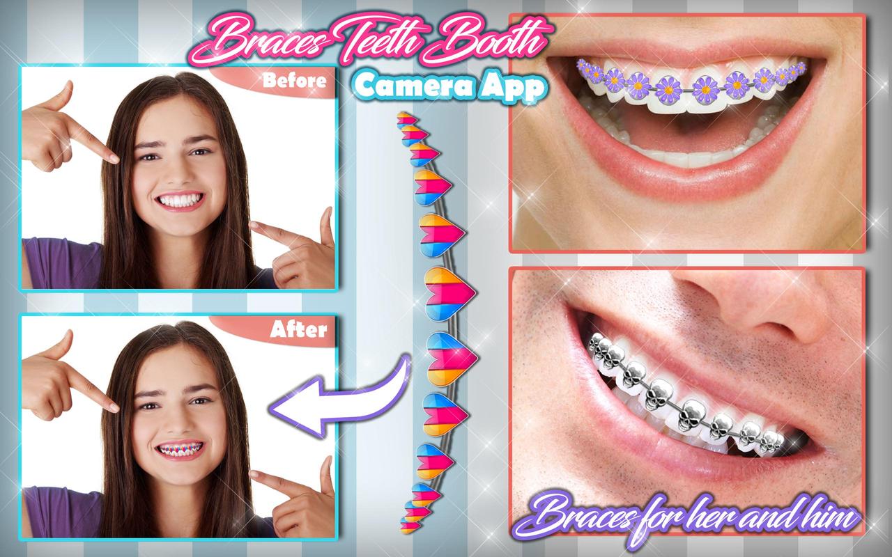 braces teeth booth camera app apk download free personalization