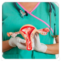 Cervical Cancer Tips