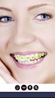 Braces Bretelles Pro تصوير الشاشة 1