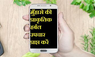 CHEHRY KI ACNE KA DESI ILAJ bài đăng