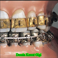 Design of Braces