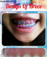 Design of Braces اسکرین شاٹ 3