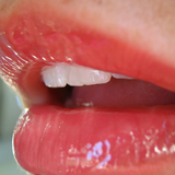 Remedy to Lighten Dark Lips icon