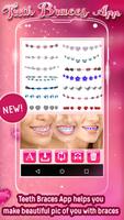 Teeth Braces App screenshot 2