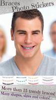 Teeth Braces Photo Editor App স্ক্রিনশট 1