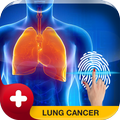 Lung Cancer Scanner Prank
