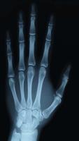 X-Ray Scanner Prank Ekran Görüntüsü 1
