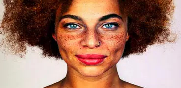 Freckles Tips
