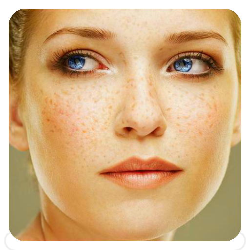 Freckles Tips