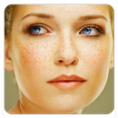 Freckles APK