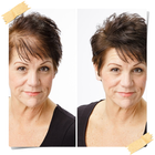 How to Regrow Hair Naturally Zeichen