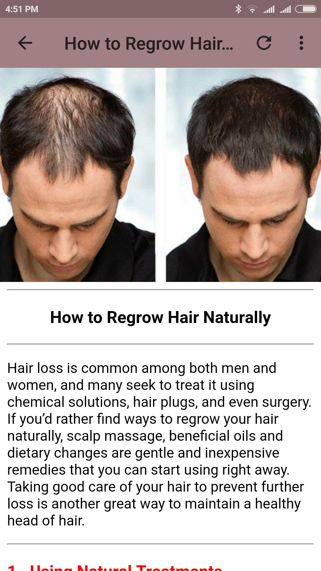 How To Regrow Hair Naturally For Android Apk Download
