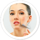 How to Get Rid of Acne APK