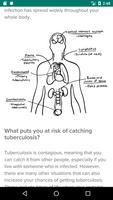 Infectious diseases Cartaz