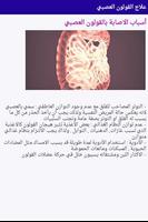 علاج القولون العصبي screenshot 1