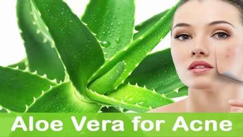 Health Benefits of Aloe Vera Screenshot 3