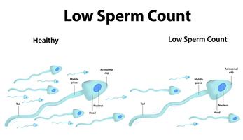 Accroître quantité de sperme Affiche