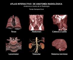 Atlas de Anatomia Radiológica capture d'écran 1