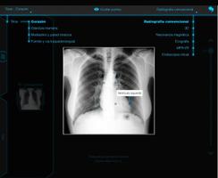 Atlas de Anatomia Radiológica capture d'écran 2