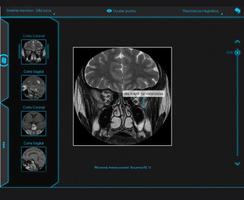 Atlas de Anatomia Radiológica capture d'écran 3