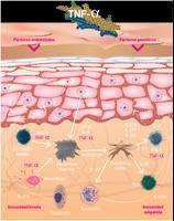 PSoriasis screenshot 3