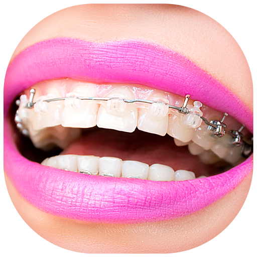 Pretty Braces Colors App