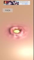 Pimple Squeezer Ekran Görüntüsü 2