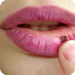Cold Sores Treatment