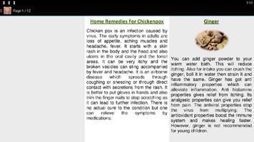 برنامه‌نما Home Remedy for Chicken Pox عکس از صفحه